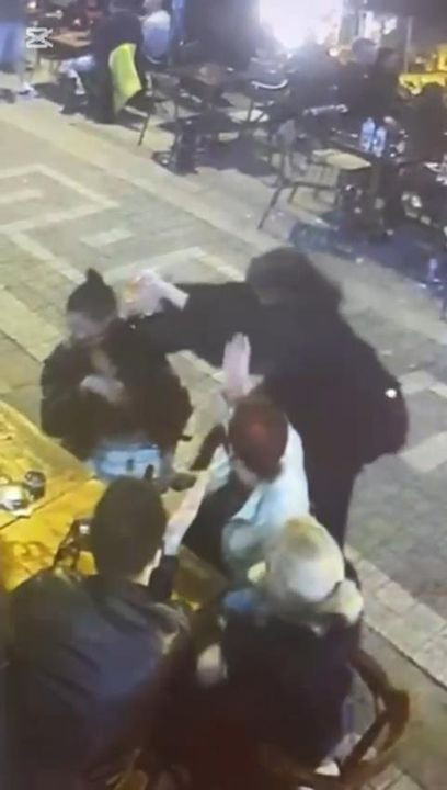 Önce çakmakla yakıldı ardından tehdit mesajları aldı: 'Kız arkadaşım sizin yüzünüzden...' - Resim: 7