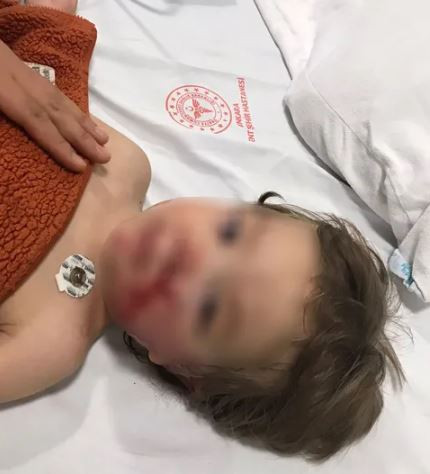 Ankara'da pitpull dehşeti! İki küçük çocuğa saldırdı! Acılı babanın sözleri yürekleri dağladı! Köpek sahibi tutuklandı - Resim : 1