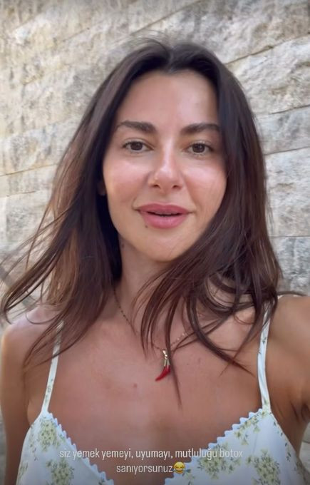 Nesrin Cavadzade'den botoks iddialarına yanıt: "Fresh görünmeye alışık değilsiniz" - Resim: 5