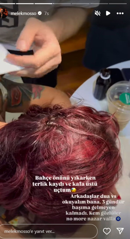 Melek Mosso'dan korkutan haber! Kaza geçirdi - Resim: 3