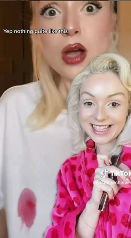 İzleyenler şoka girdi! Meme ucu kopan kadının yaşadıkları dehşete düşürdü - Resim: 3