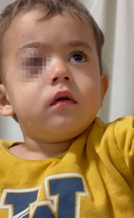 İnegöl’de torpil faciası! 2 yaşındaki Alpaslan gözünü kaybetti! Baba, fırıncıyı daha önce uyarmış! - Resim: 1