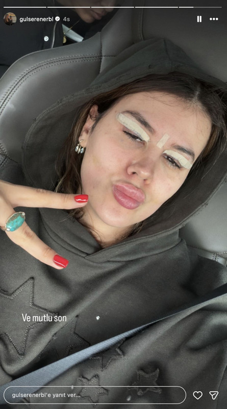 Mehmet Ali Erbil'in 42 yaş küçük eşi bıçak altına yattı! "Mutlu son" deyip son halini paylaştı - Resim: 5