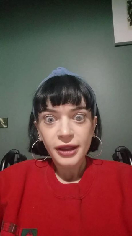 Ünlü oyuncudan kötü haber! İkinci bacağını da kaybetti - Resim: 2