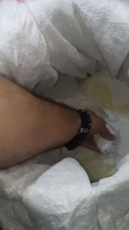 Aile binasında akılalmaz olay! Ekipler bile gördüklerine inanamadı: Dikkat çeken 'peçete' detayı - Resim: 6