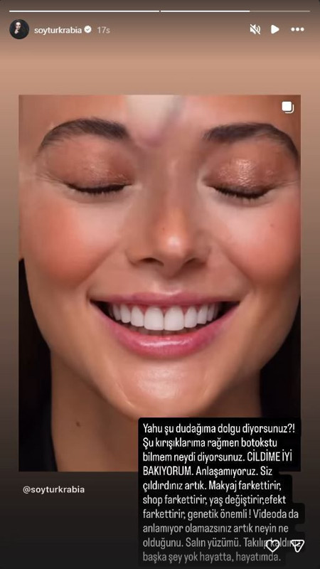 Rabia Soytürk'ten estetik iddialarına sert çıkış! "Siz çıldırdınız artık!" diyerek açtı ağzını yumdu gözünü - Resim: 6