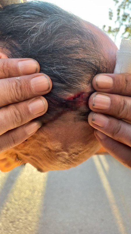 İstanbul Kartal'da taksimetre kavgası! Sinirlenen müşteri taksiciyi yaraladı! Söyledikleri ise şoke etti! - Resim: 3