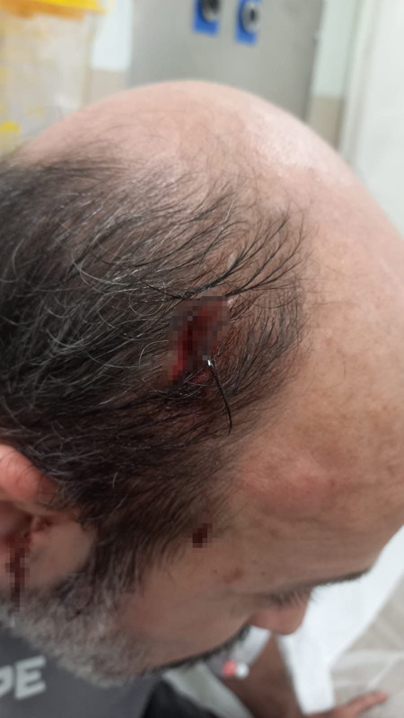 İstanbul Kartal'da taksimetre kavgası! Sinirlenen müşteri taksiciyi yaraladı! Söyledikleri ise şoke etti! - Resim: 4