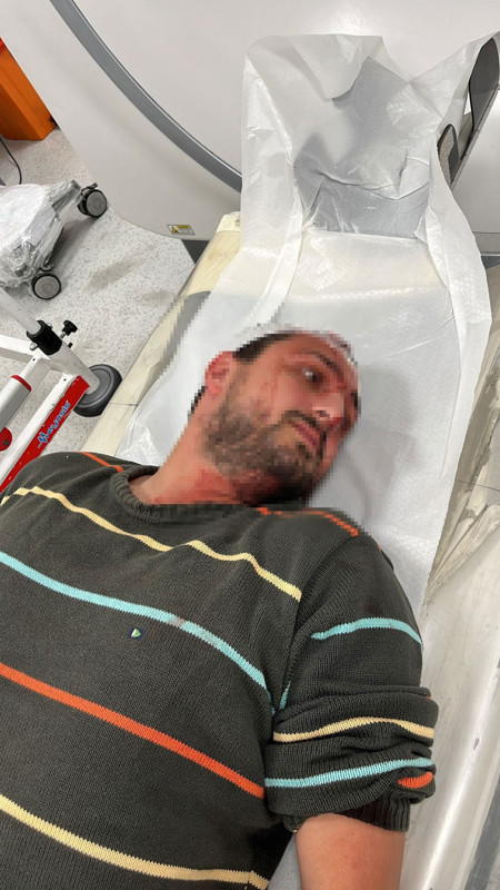 Vicdanları sızlatan olay! “Odunluğa baktı” diye dehşet yaşattılar: Otizmli adamı odunla dövdüler - Resim: 4