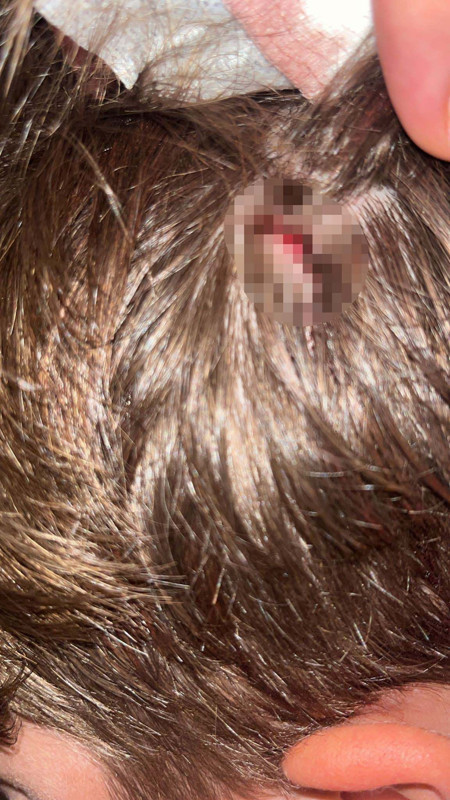 Yalova'daki komşu dehşeti sürüyor!  Bu kez 8 yaşındaki çocuklarına taşla saldırdılar - Resim: 4