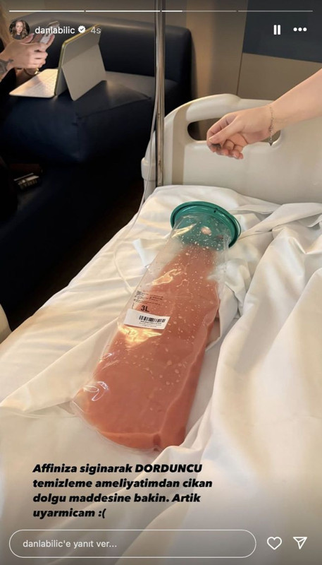 Kalça dolgusu kaburgasına çıkmıştı! 4'üncü kez bıçak altına yatan Danla Bilic'in vücudundan çıkan şey şoke etti! Takipçilerini bir kez daha uyardı - Resim: 6