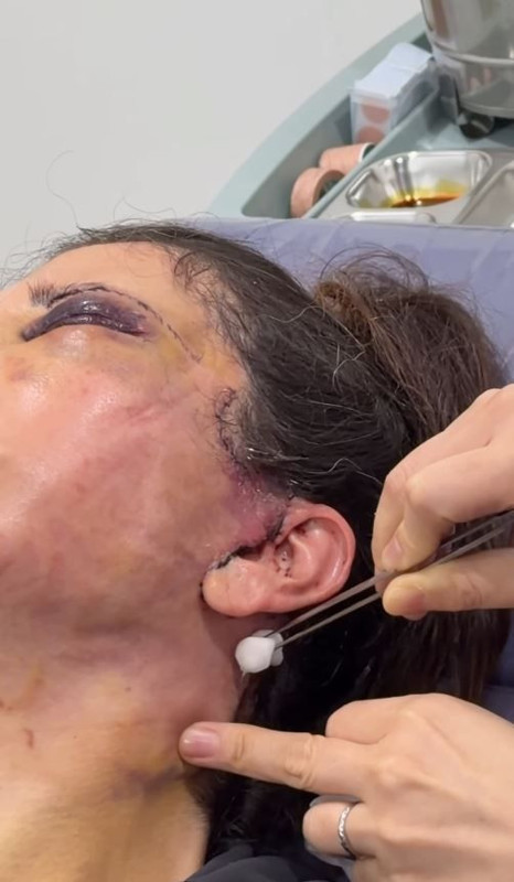 Yüz nakli sonrası hayatını kabusa dönmüştü! Didem Ceran Bali'de arınma ritüeline katıldı - Resim: 4