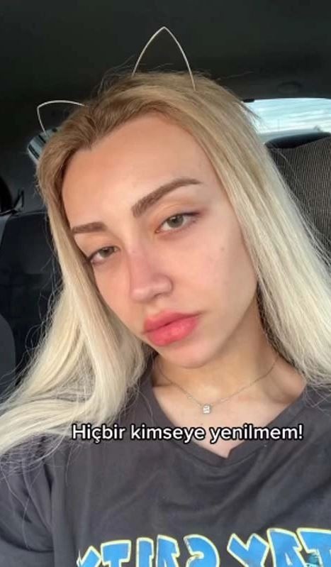 TikTok fenomeni Mika Raun kalça ve göğüs yaptırdı! Hayranları şok oldu! "Resmen kadın gibi..." - Resim: 18