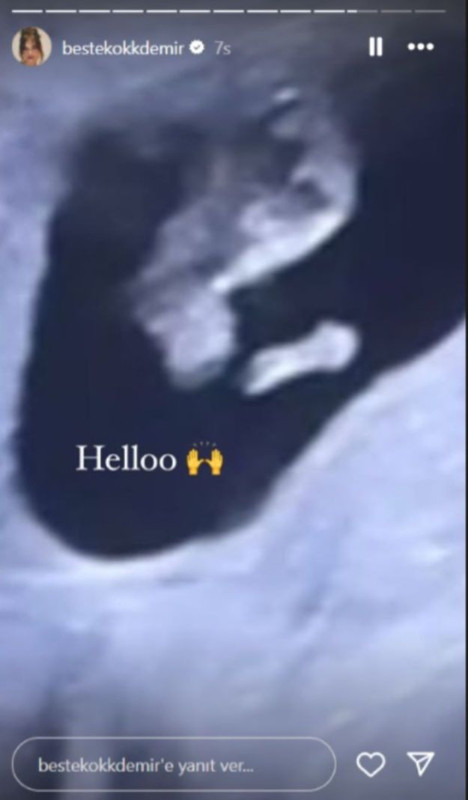 Düğün gününde bebek müjdesi vermişti! Beste Kökdemir'den gelen eleştirilere tepki - Resim: 5