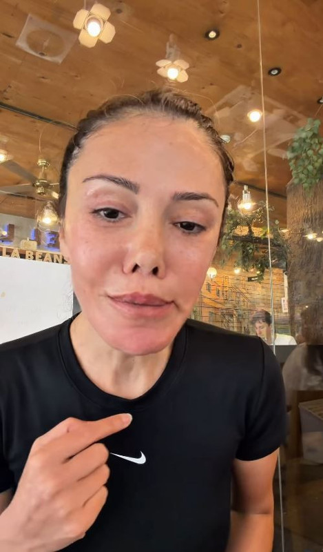 Yüz nakli olan Didem Ceran'dan olay paylaşım: Kendisini dünyaca ünlü şarkıcıyla karşılaştırdı - Resim: 5