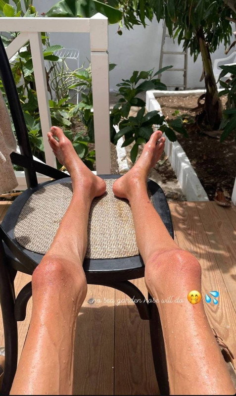 22 kiloya kadar düşmüştü! Sosyal medya fenomeni hayatını kaybetti - Resim: 3