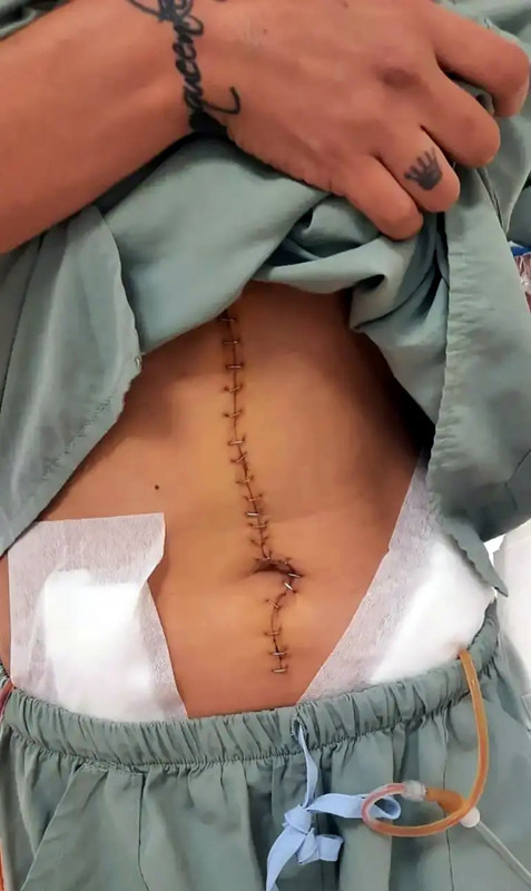 Fenomen Yağmur Taktaş hayatını kaybetmişti! Otopsi detayları dehşete düşürdü: Ayakları bağlandı, sigara söndürüldü, aç bırakıldı - Resim: 5