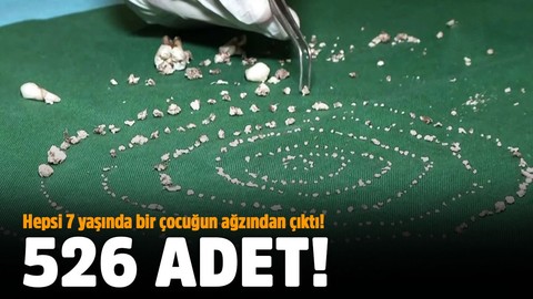 Hepsi 7 yaşında bir çocuğun ağzından çıktı!.. 526 adet!