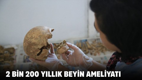 2 bin 200 yıllık beyin ameliyatı