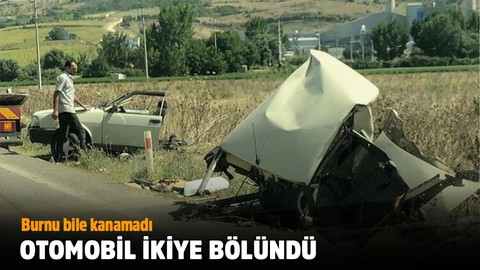 İkiye bölündü! Burnu bile kanamadı