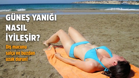 Güneş yanığı nasıl iyileşir?