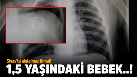 Sivas’ta akılalmaz ihmal!.. 1,5 yaşındaki bebek…