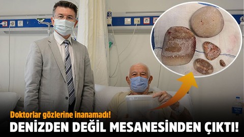 Doktorlar gözlerine inanamadı!.. Denizden değil mesanesinden çıktı!