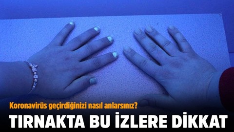 Koronavirüste tırnak belirtisi!
