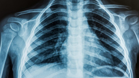 Karın ağrısı şikayetiyle acile gitti, röntgenine bakan doktorlar az kalsın mesleği bırakıyordu