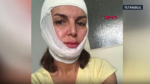 Topuklu ayakkabı sesine kızıp dakikalarca darp etti