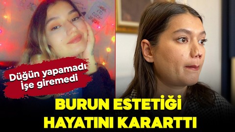 Burnu daha güzel olsun istemişti! Yaptırdığı operasyonla hayatı karardı: Dışarı çıktığımda insanlar öcü gibi bakıyor