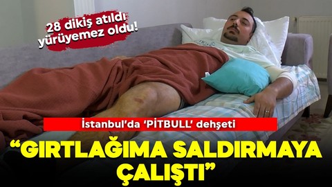 İstanbul'da pitbull dehşeti! "Gırtlağıma saldırmaya çalıştı"