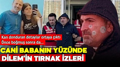 13 yaşındaki kızını boğarak öldürmüştü! Cani babanın yüzündeki tırnak izleri vahşeti gösterdi