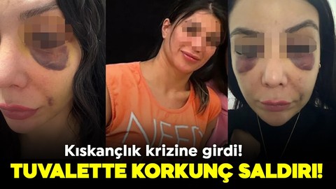 İş arkadaşını müşteriden kıskandı kıskançlık krizine girdi! Genç kadının yüzünü tanınmaz hale getirdi