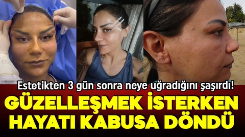 Güzelleşmek isterken hayatı karardı! 220 bin TL harcadı ama aynaya bakamıyor!
