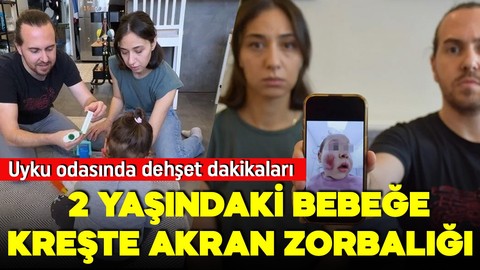 İki yaşındaki bebeğe kreşte akran zorbalığı! Yüzü parçalandı ve morardı!