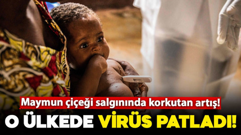 Maymun çiçeği salgınında korkutan artış! O ülkede virüs patladı