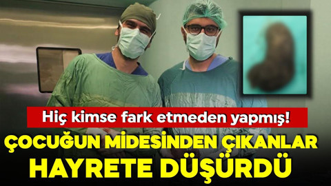 9 yaşındaki çocuğun midesinden çıkanlar hayrete düşürdü