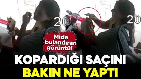 Mide bulandıran görüntü! Kopardığı saçını bakın ne yaptı