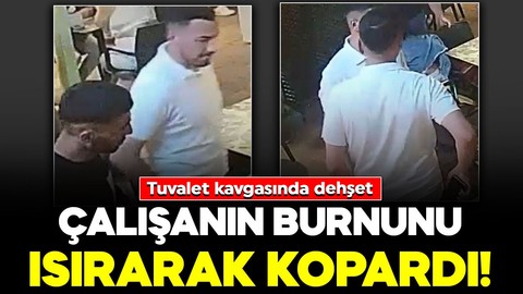 Tuvalet kavgasında dehşet! Çalışanın burnunu ısırarak kopardı