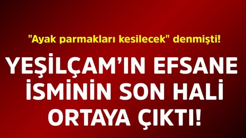 "Ayak parmakları kesilecek" denmişti! Yeşilçam'ın efsane isminin son hali ortaya çıktı