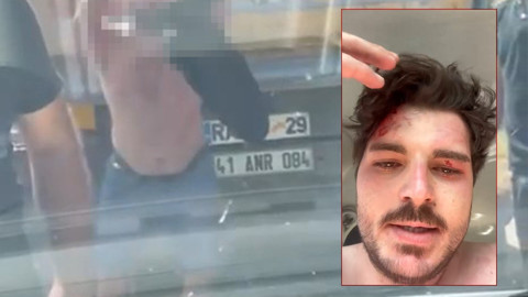 Ünlü oyuncu trafikte darp edildi! Az daha canından oluyordu: "Büyük ihtimalle öldürene kadar döveceklerdi"