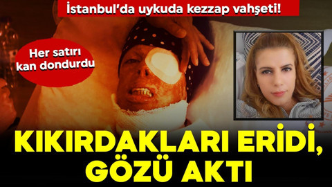 İstanbul’da uykuda kezzap vahşeti! Kıkırdakları eridi, gözü aktı! Her satırı kan dondurdu