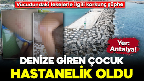Antalya'da deniz enfeksiyonu alarmı! 9 yaşındaki çocuk hastanelik oldu: Vücudundaki lekelerle ilgili korkunç şüphe