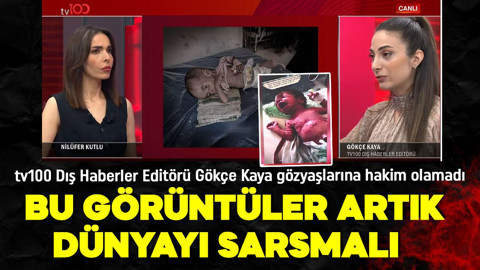 Gazze’de açlık felaketi! Çocuklar hayatını kaybediyor! Bu görüntüler artık dünyayı sarsmalı!