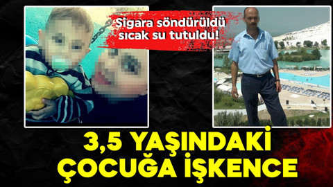 Konya'da 3,5 yaşındaki çocuğa şiddet! Sigara söndürüldü, sıcak su tutuldu!