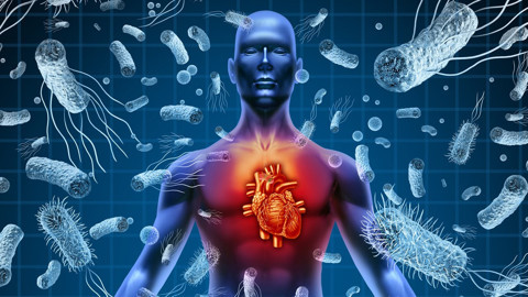 Dünyada her 5 can kaybından 1'inin sebebi! Uzmanlar milyonları öldüren sepsise karşı uyarıyor: Bu hataları sakın yapmayın