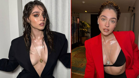 Ünlü oyuncu Cemre Baysel'den kötü haber! Sette kaza geçirdi