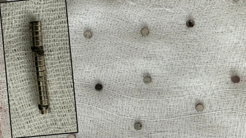 Evde rahatsızlandı, doktorları şoke etti! Tam 19 tanesi boğazından çıktı