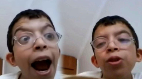 Sosyal medyada "Tablet Reis" olarak tanınıyordu! Ünlü fenomen 5 ayrı yüz ameliyatı oldu, son hali görenleri şoke etti